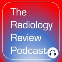 Chest Radiology: Randomly Distributed Lung Diseases and More