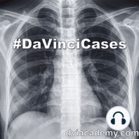 #DaVinciCases Musculoskeletal 7 - Spine Radiology 1