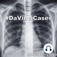 Pressure-Volume Loops for Left Ventricle [#DaVinciCases Cardiovascular 3 - Physiology Case 1]