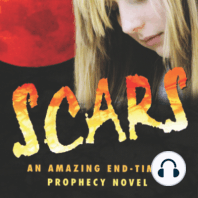 Scars