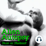 Alien Autopsy