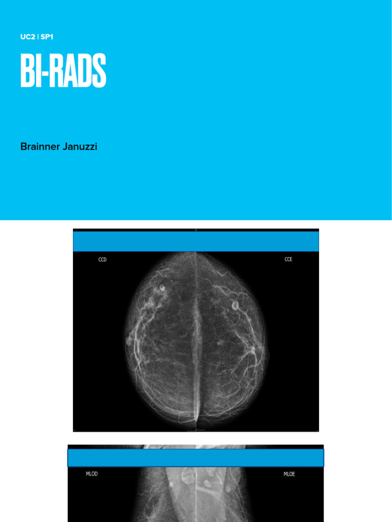 Bi Rads | PDF