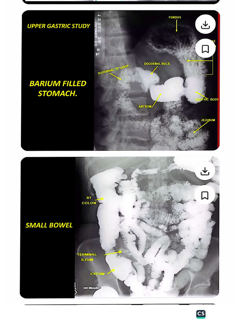 Radiographic Anatomy of Abd 1 | PDF