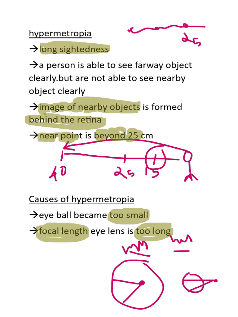 Hyper Metro Pia | PDF