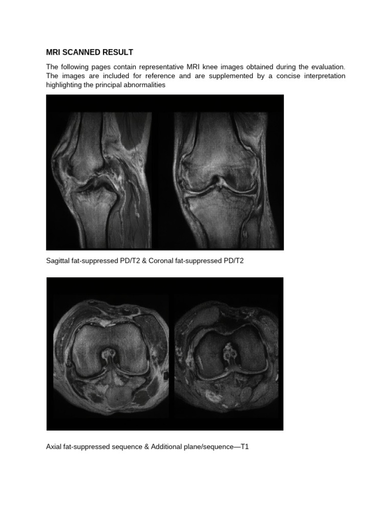 Mri Scanned Result | PDF