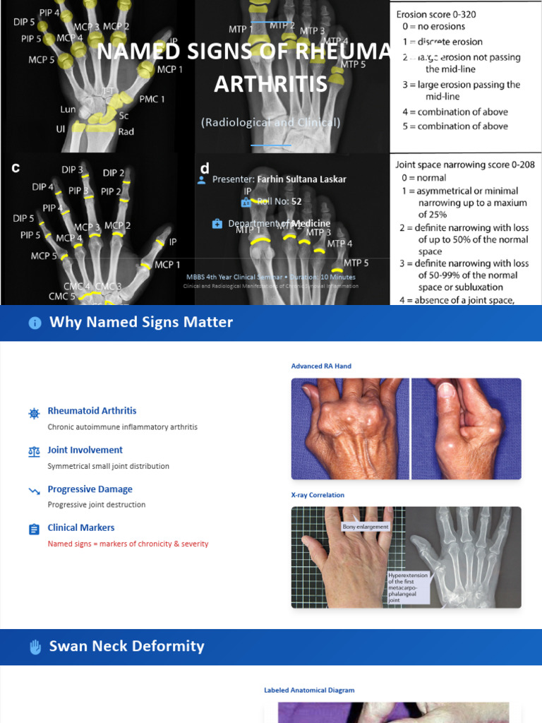 Named Signs of Rheumatoid Arthritis | PDF | Arthritis | Rheumatoid ...