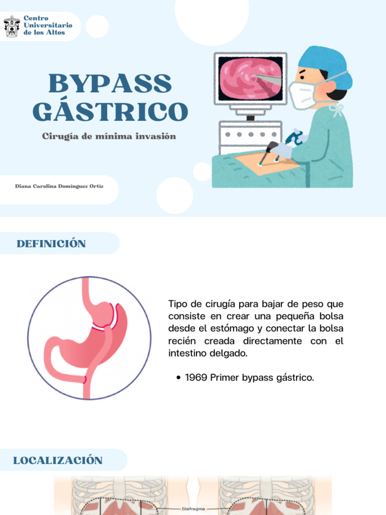 Bypass | PDF | Estómago | Tracto gastrointestinal