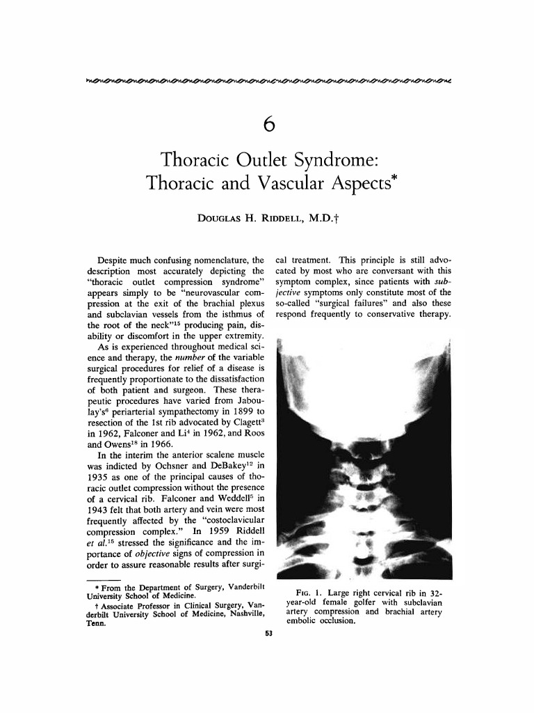 Thoracic Outlet Syndrome (RIDDELL, DOUGLAS H.) | PDF