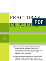 Fracturas de Peroné