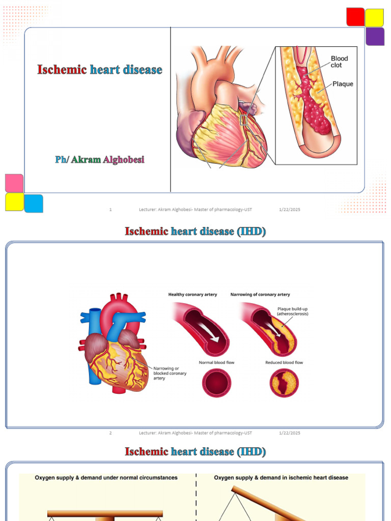 Ischemic Heart Disease Last Update | PDF | Coronary Artery Disease | Heart