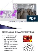 NEOPLASIAS HEMATOPOYETICAS Presentacion