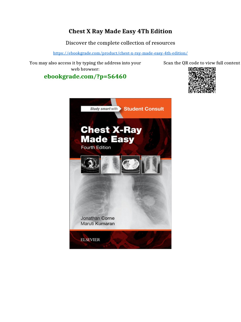 Chest X Ray Made Easy 4th Edition Full Access | PDF | Panic Attack | Pain