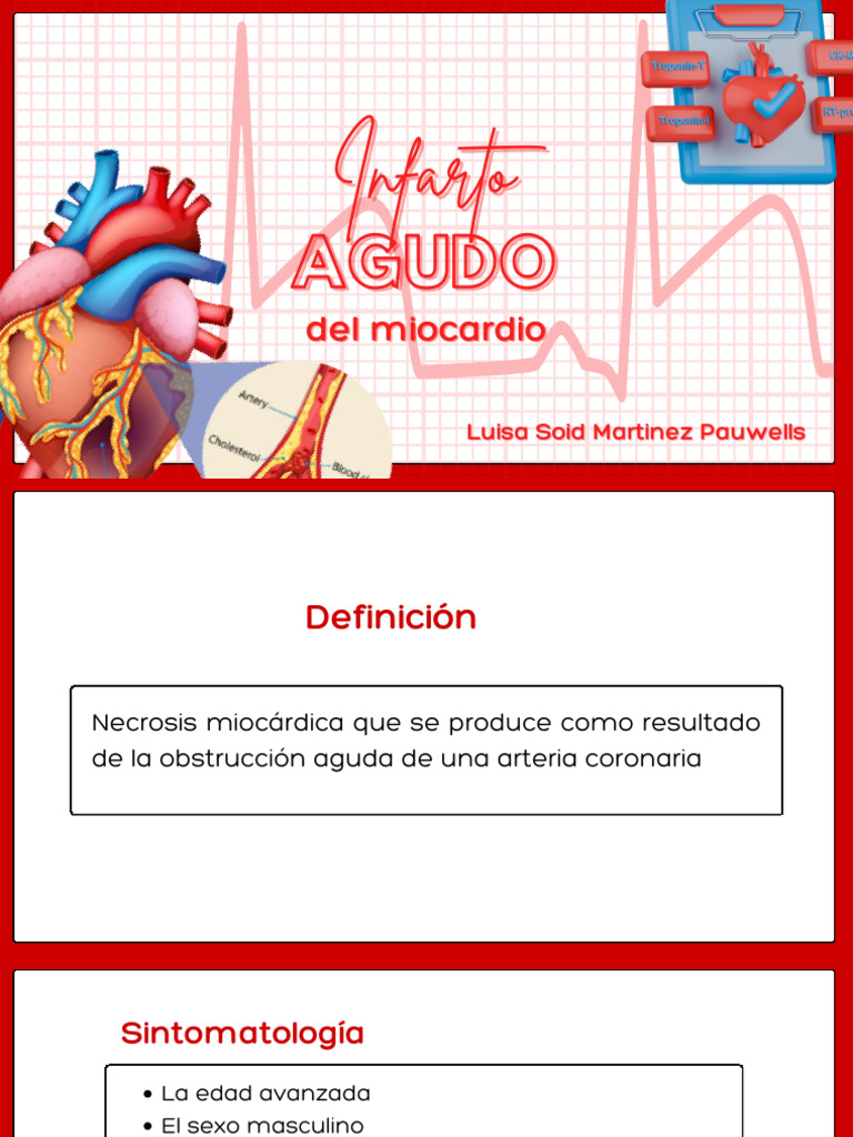 Flash Cards Infarto Agudo Del Miocardio | PDF | Infarto de miocardio ...