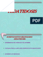 DEFENSA Hidatidosis-Cisticercosis