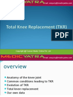 Knee Replacement Surgery