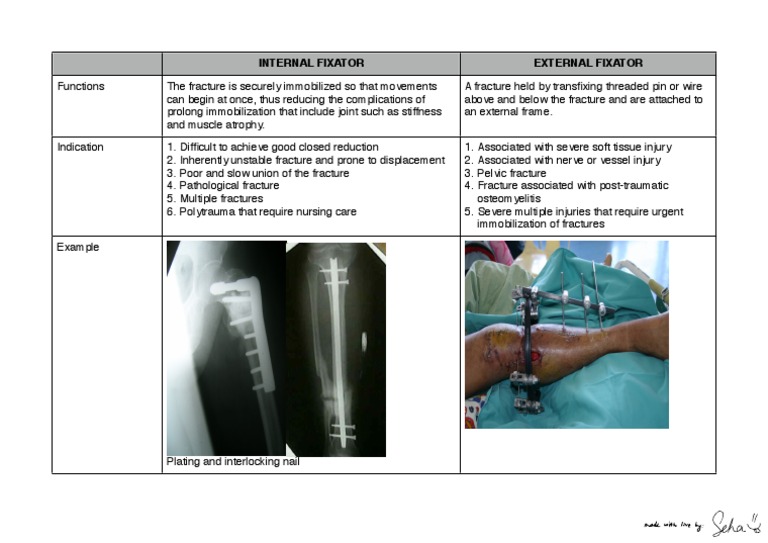 Internal vs External Fixators Explained | PDF | Science & Mathematics ...