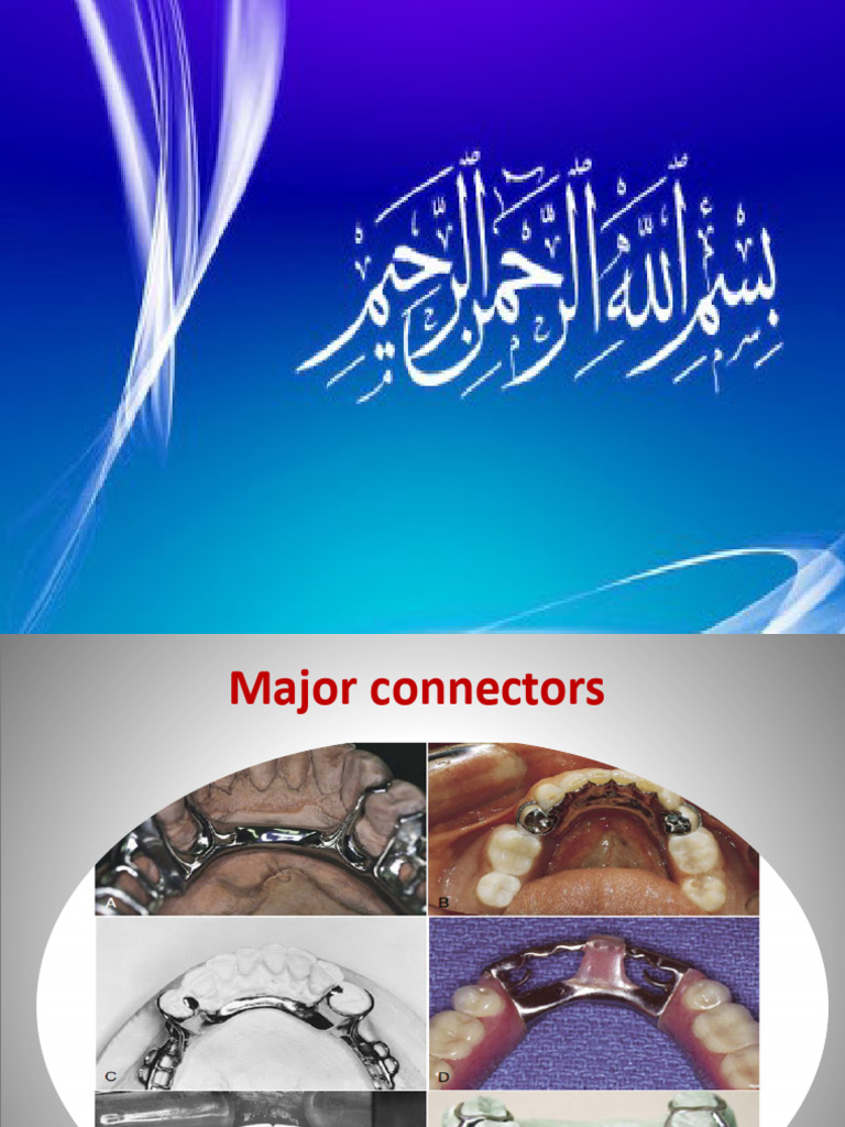 6-Max. Major Connector | PDF | Dental Anatomy | Dentistry
