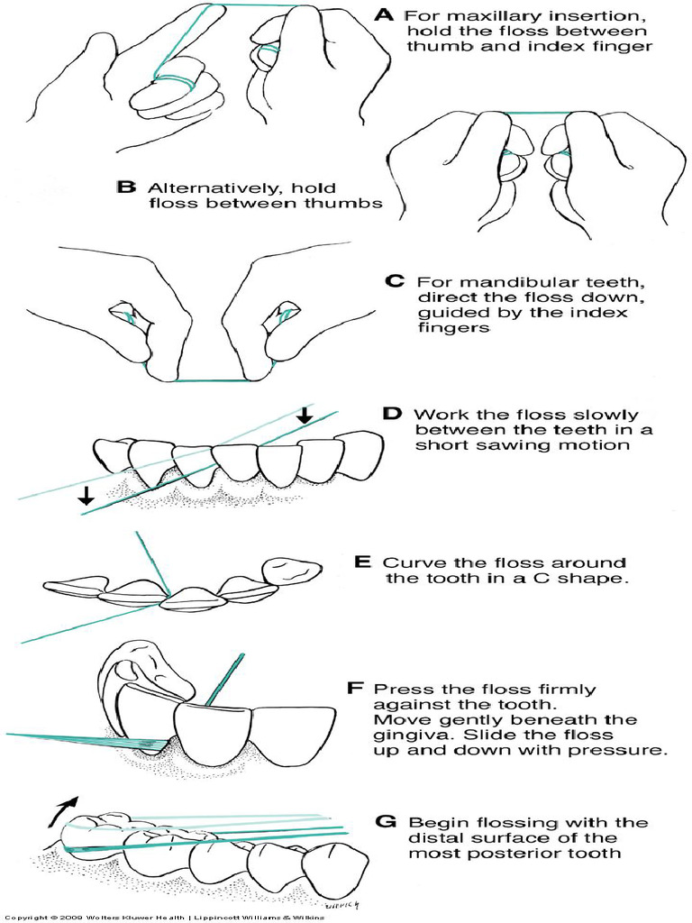 Flossing Technique | PDF