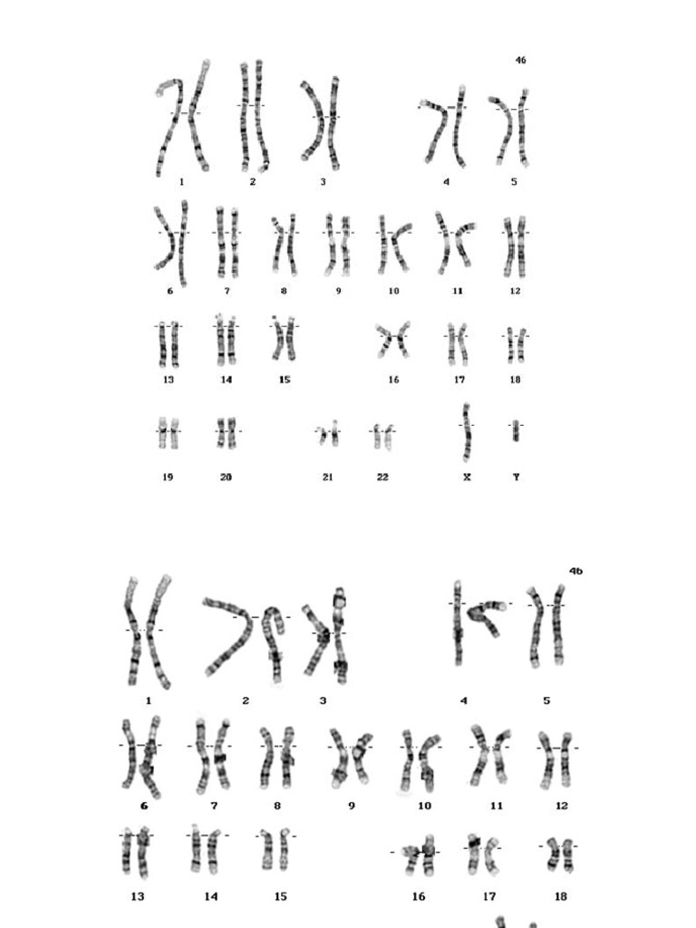 Practical Unit 2 Human Polyploidy | PDF