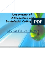 Guide to Serial Extraction in Orthodontic Treatment