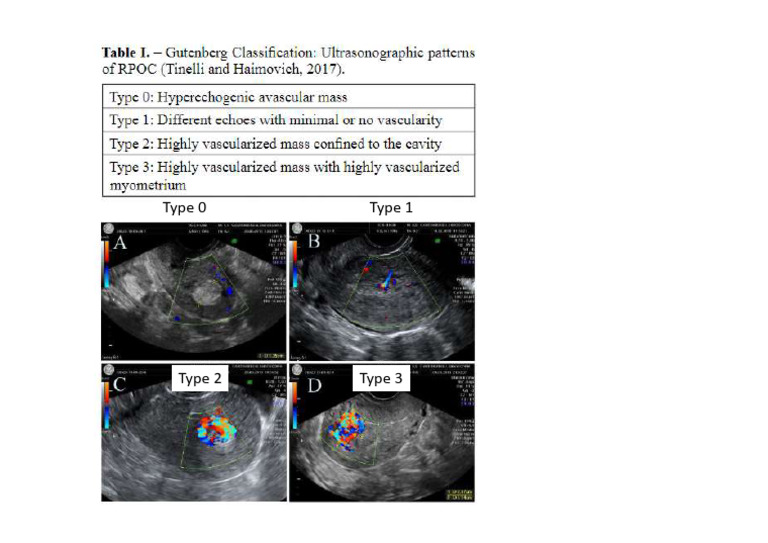 Gutenberg Classification Ultrasonographic Patterns of RPOC | PDF