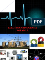 Electrocardiograma Normala