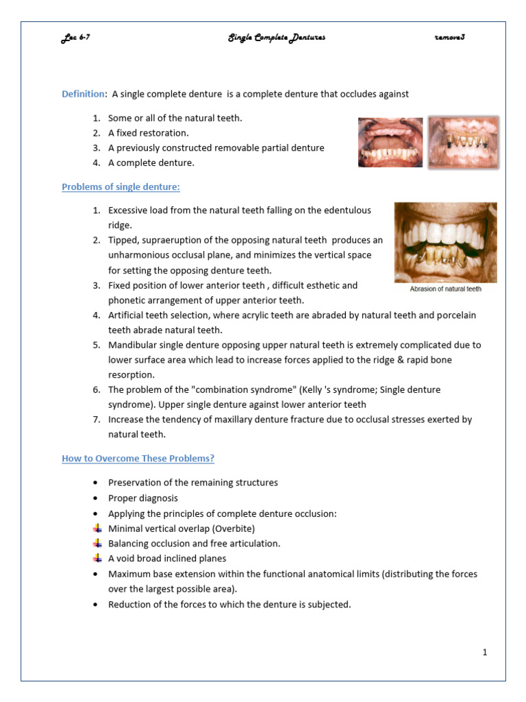 Lec6-7 Single-Complete-Denture | PDF | Dentures | Tooth