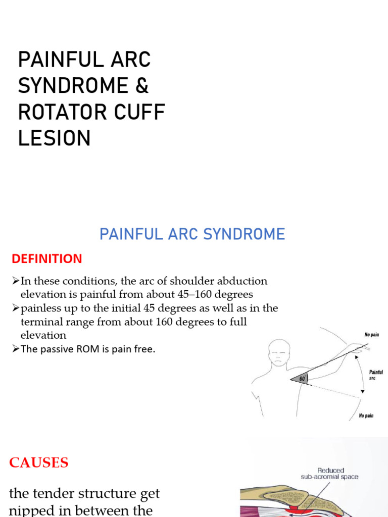 Rotator Cuff Lesion PDF | PDF | Shoulder | Musculoskeletal System