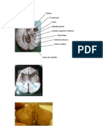 Tálamo 3° Ventrículo Fórnix Glândula Pineal Colículos (Superior e Inferior) Hipocampo Substância Branca Córtex Cerebral