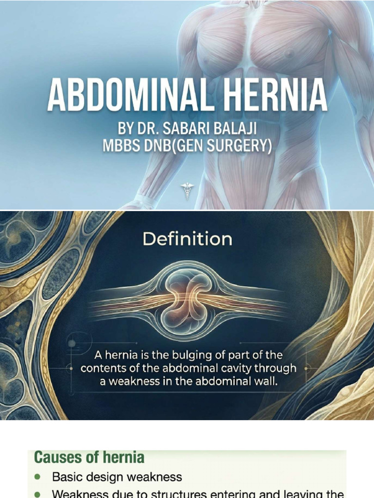 Abdominal Hernia | PDF