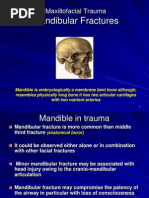 Mandibular Fractres