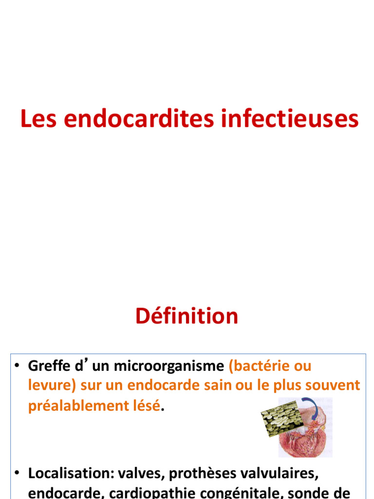 Endocardite Infectieuse | PDF | Médecine clinique | Maladies ...
