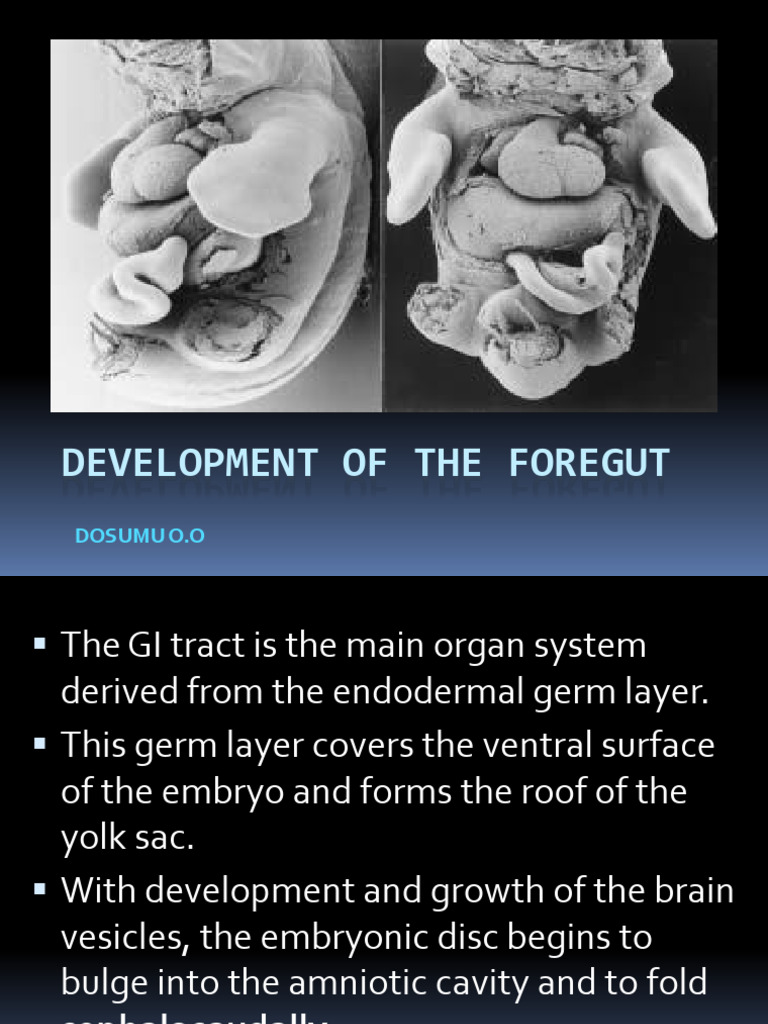 Development of The Foregut | PDF | Pancreas | Stomach