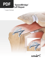 Brostrom Repair with InternalBrace Guide | PDF | Foot | Anatomical ...