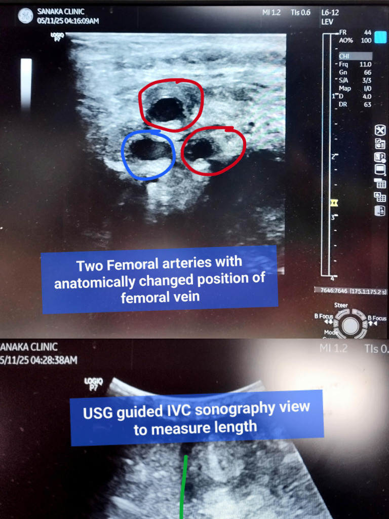 Dynamic IVC Monitoring | PDF
