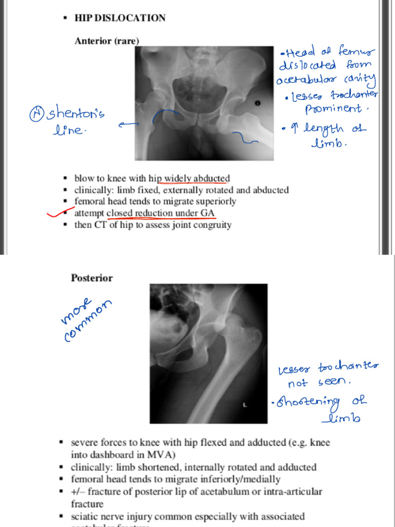 Xrays Ortho 2 | PDF