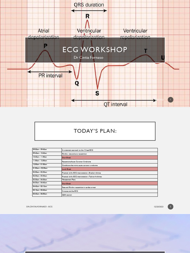 ECG Workshop 2024 Part1 | PDF | Electrocardiography | Circulatory System