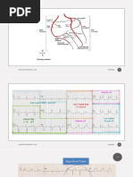 EKG Basics and Interpretation Guide | PDF | Electrocardiography ...