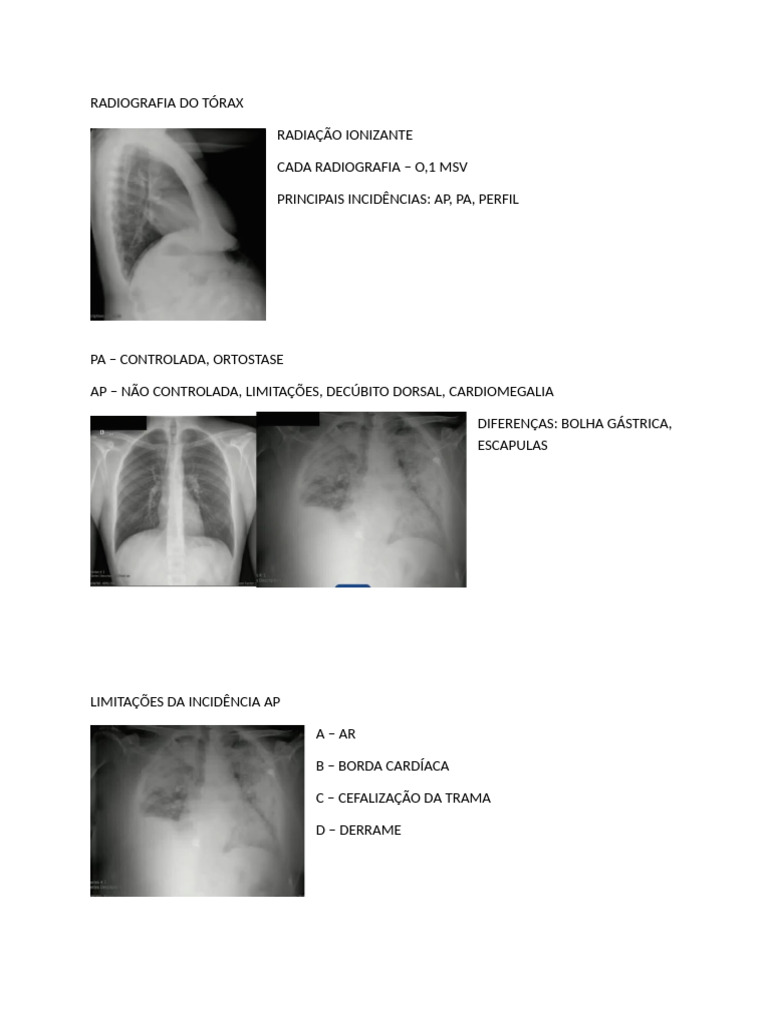Radiografia de Tórax | PDF | Coração | Neoplasmas