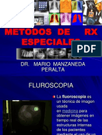 Metodos RX Especiales