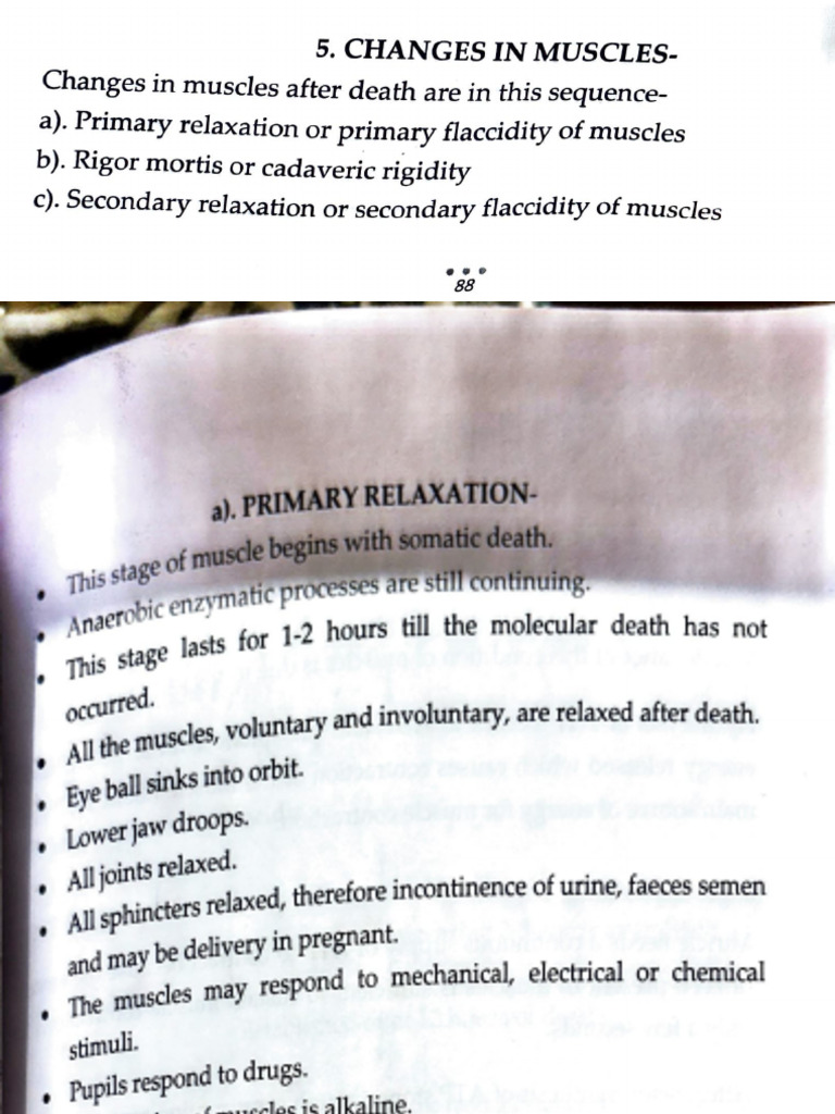 Rigor Mortis | PDF