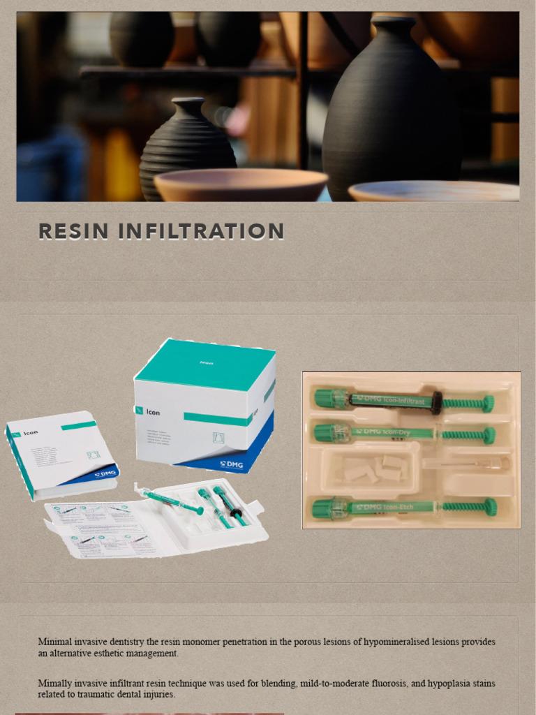 Resin Infiltration | PDF
