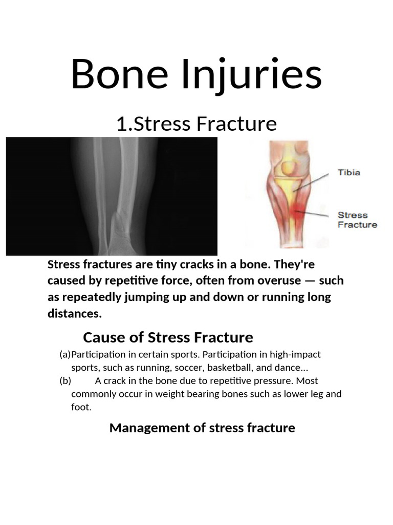 Bone Injuries | PDF