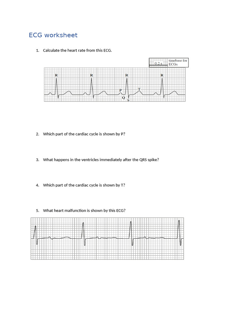 Ecg Worksheet | PDF