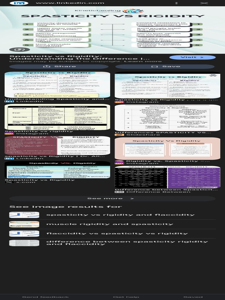 Difference Between Spasticity and Rigidity - Google Search | PDF ...