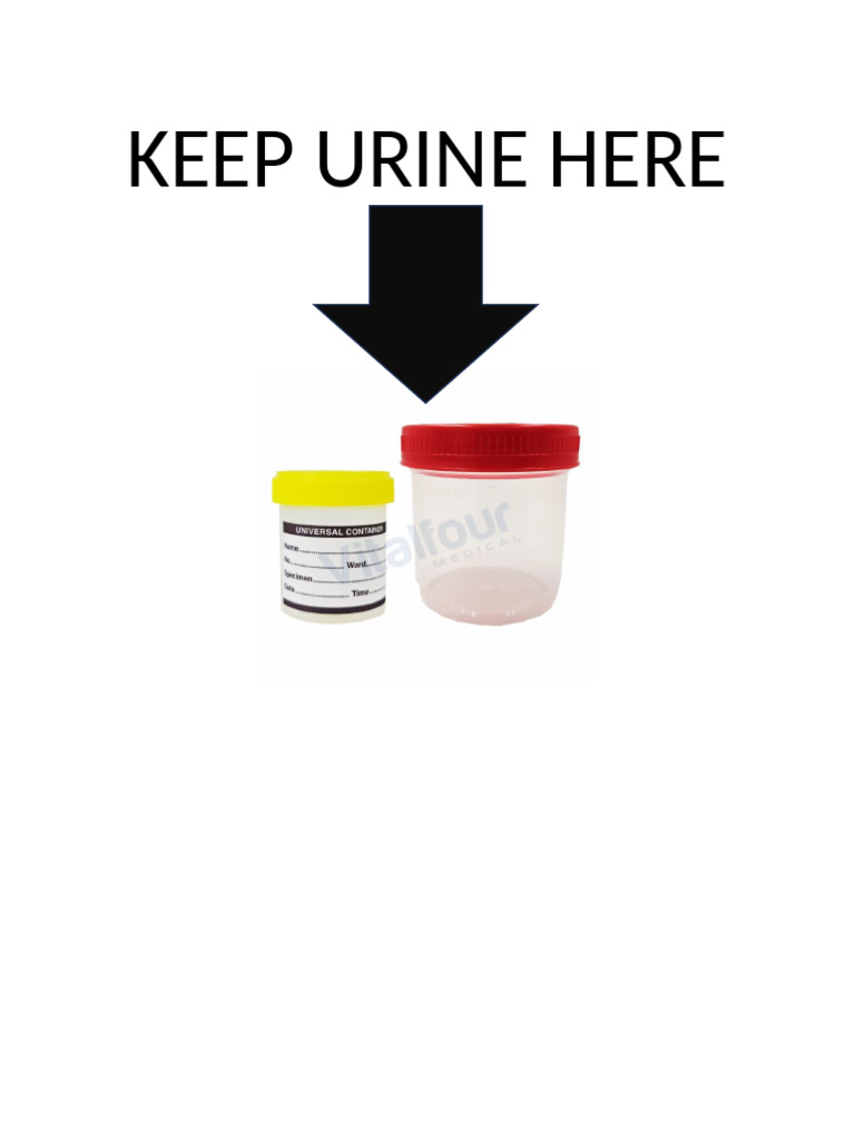 Keep Urine Here | PDF