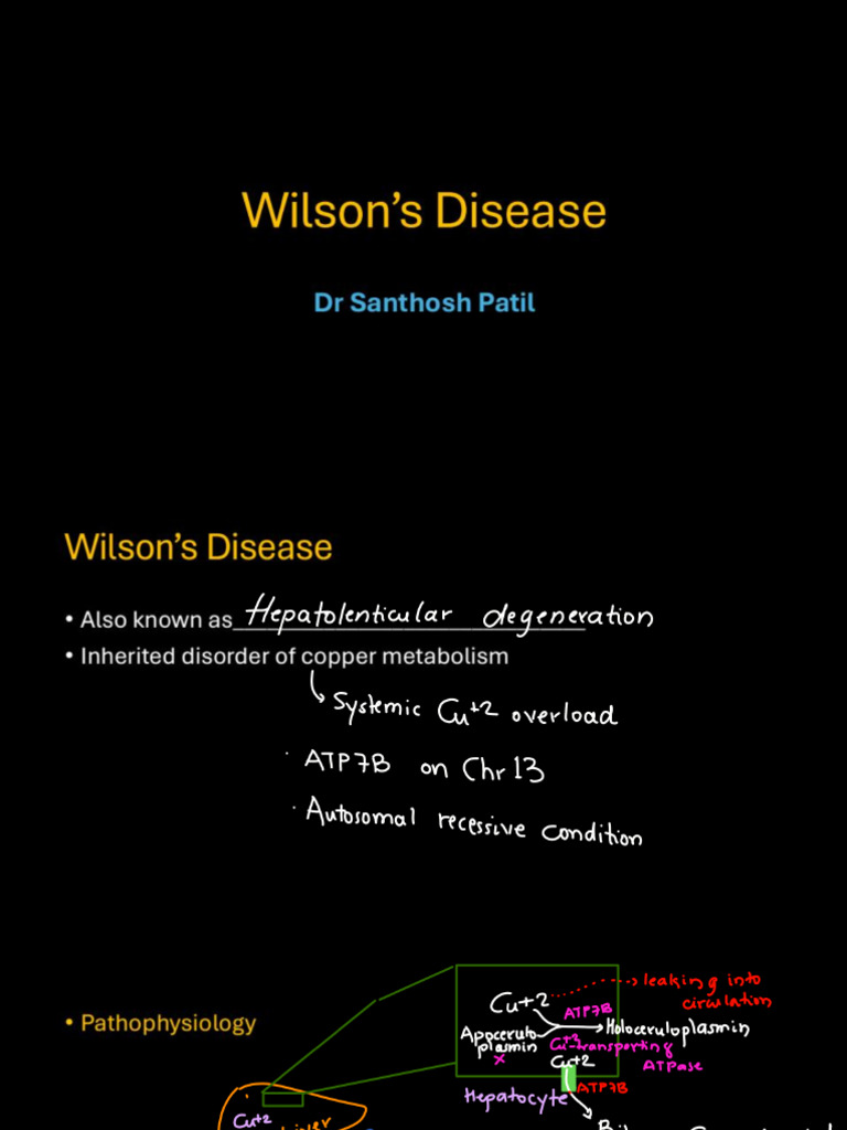 PDF Notes of Wilson's Disease Pathology Medicine Read Harrison's | PDF