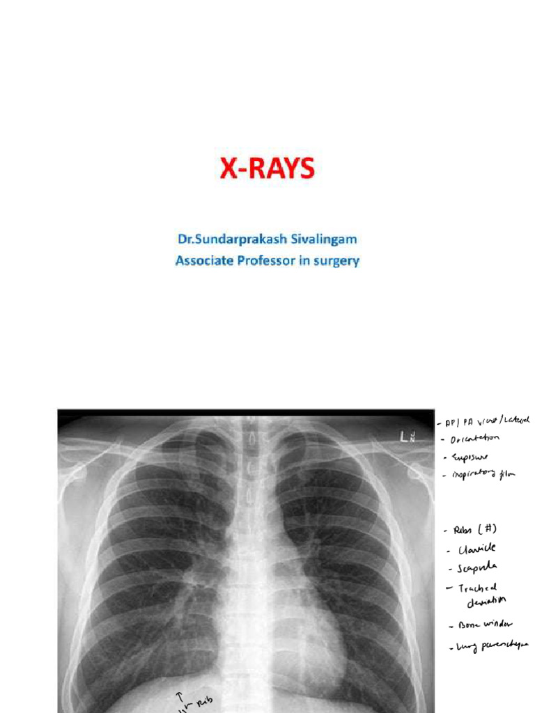Surgery X Rays | PDF | Medical Specialties | Clinical Medicine