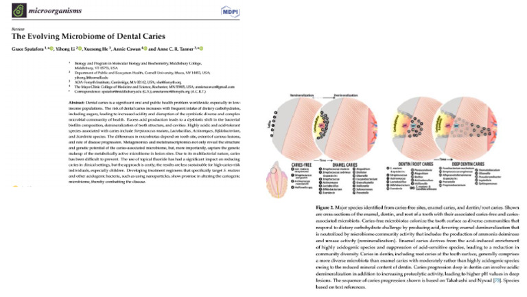 Diagrama Carie | PDF