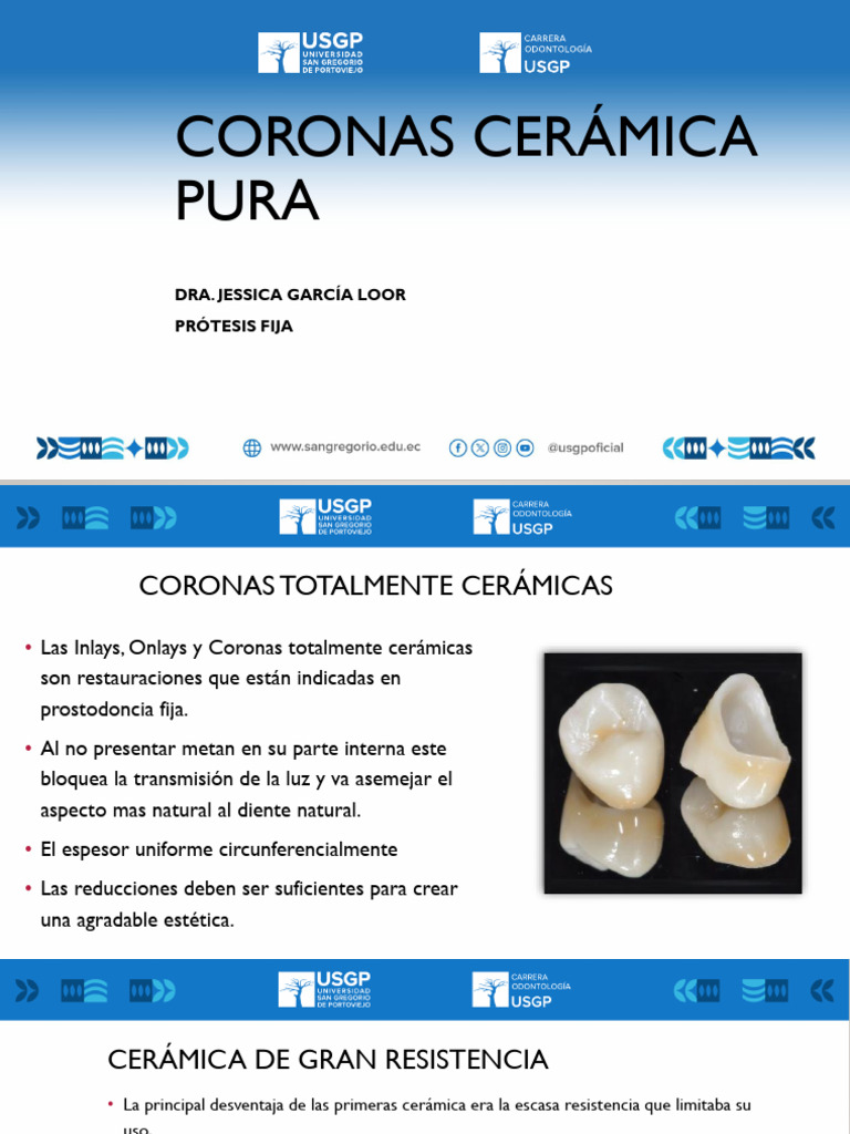 Coronas Cerámica Pura | PDF | Esmalte de dientes | Diente